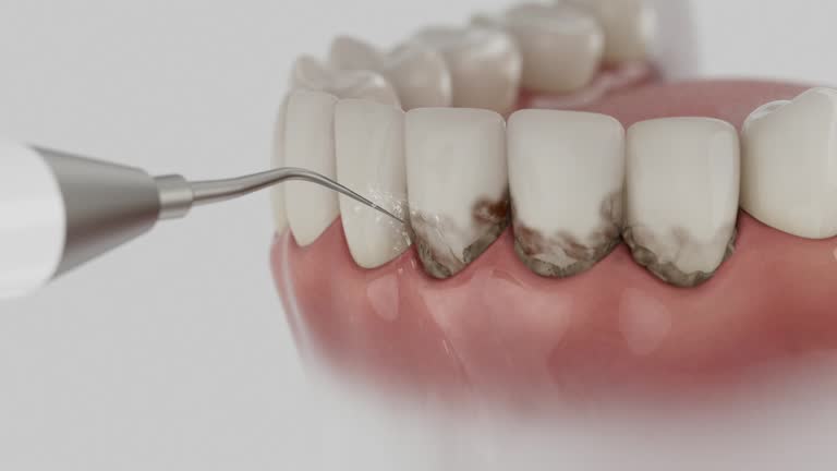 Trusted Teeth Cleaning And Checkup service in Fort Branch, IN - Dentist Open Now